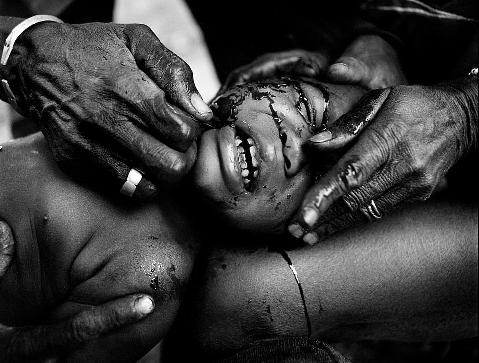 Rung minh hu tuc rach mat tre em danh dau tuoi truong thanh o Tay Phi hinh anh