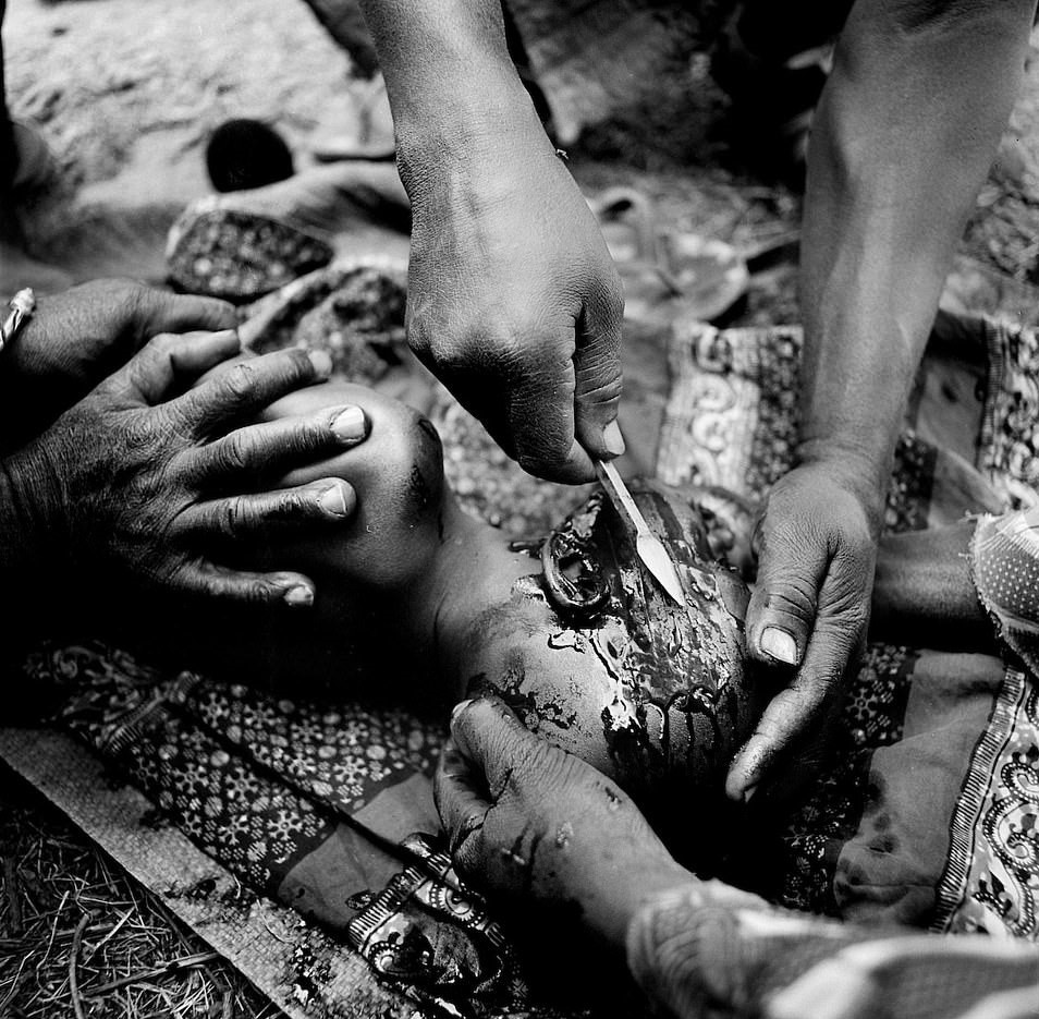 Hu tuc rach mat tre em anh 7