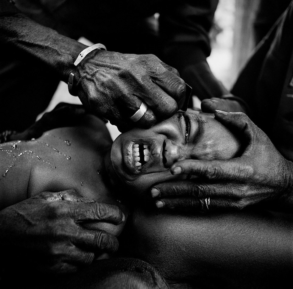 Hu tuc rach mat tre em anh 8