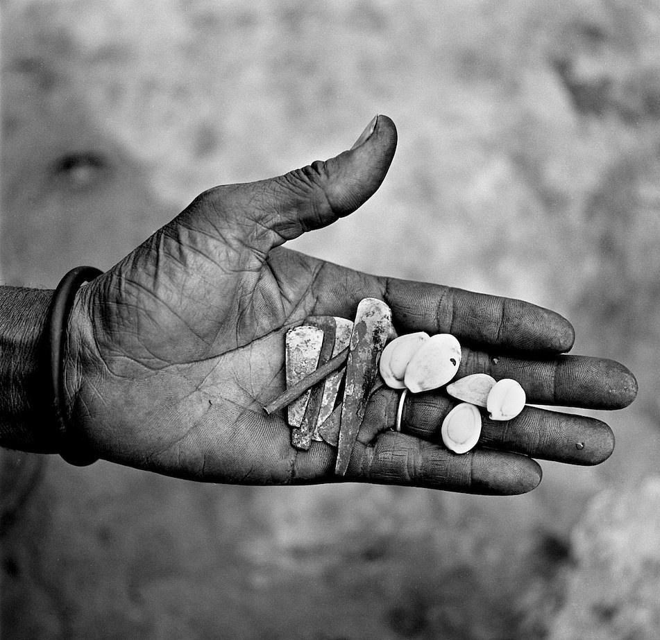 Hu tuc rach mat tre em anh 9