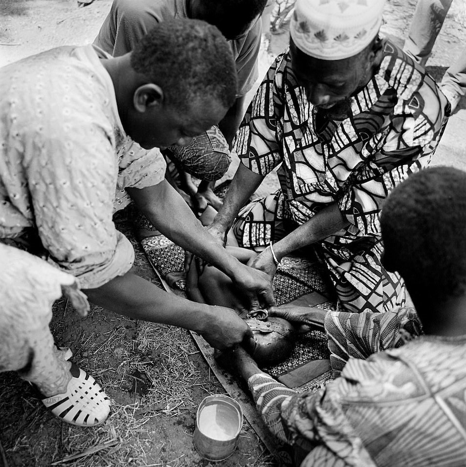 Hu tuc rach mat tre em anh 16