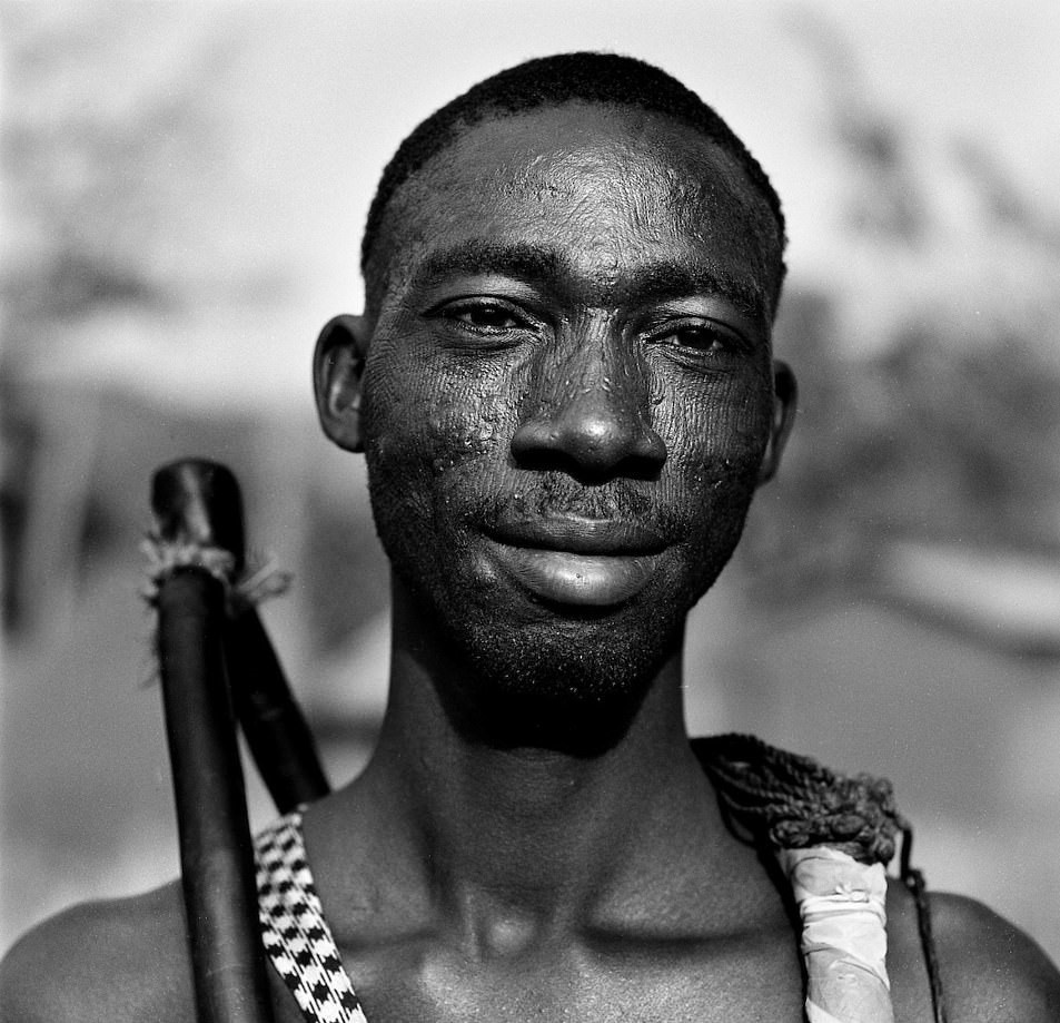 Hu tuc rach mat tre em anh 11