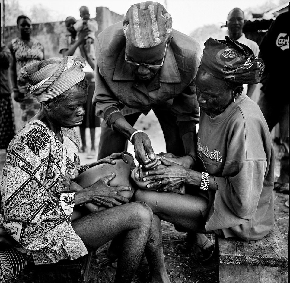 Hu tuc rach mat tre em anh 3