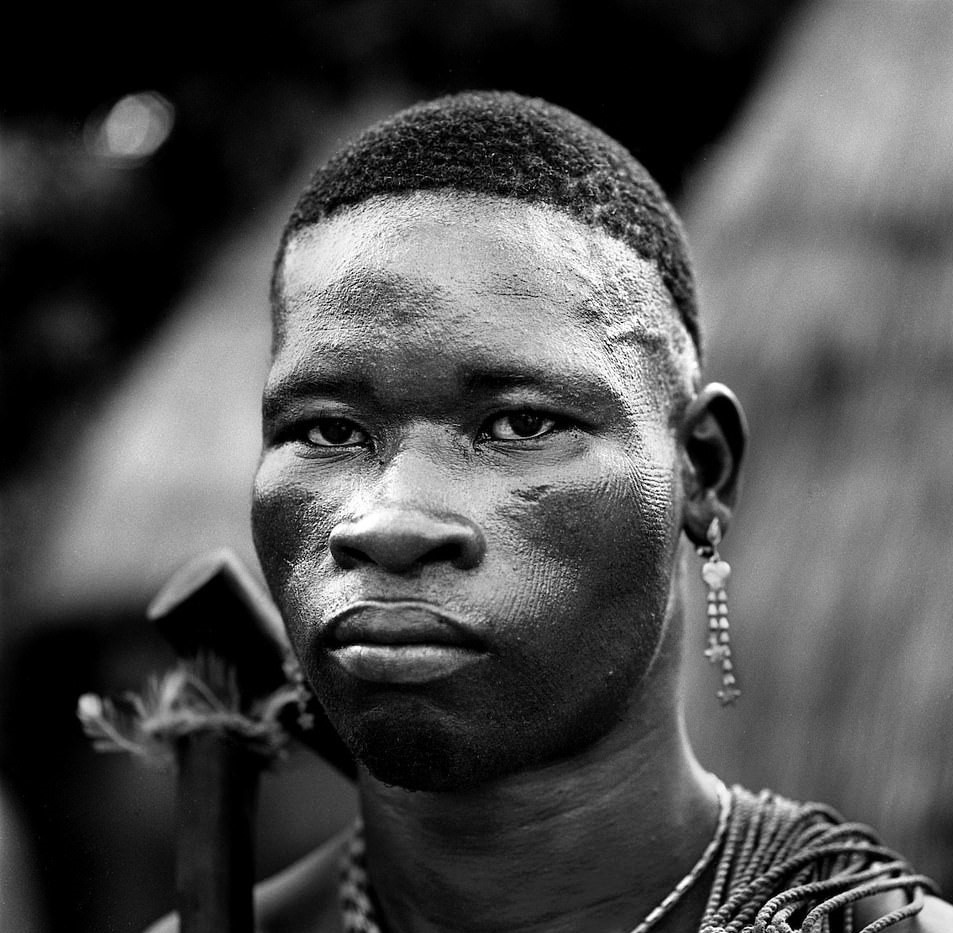 Hu tuc rach mat tre em anh 12