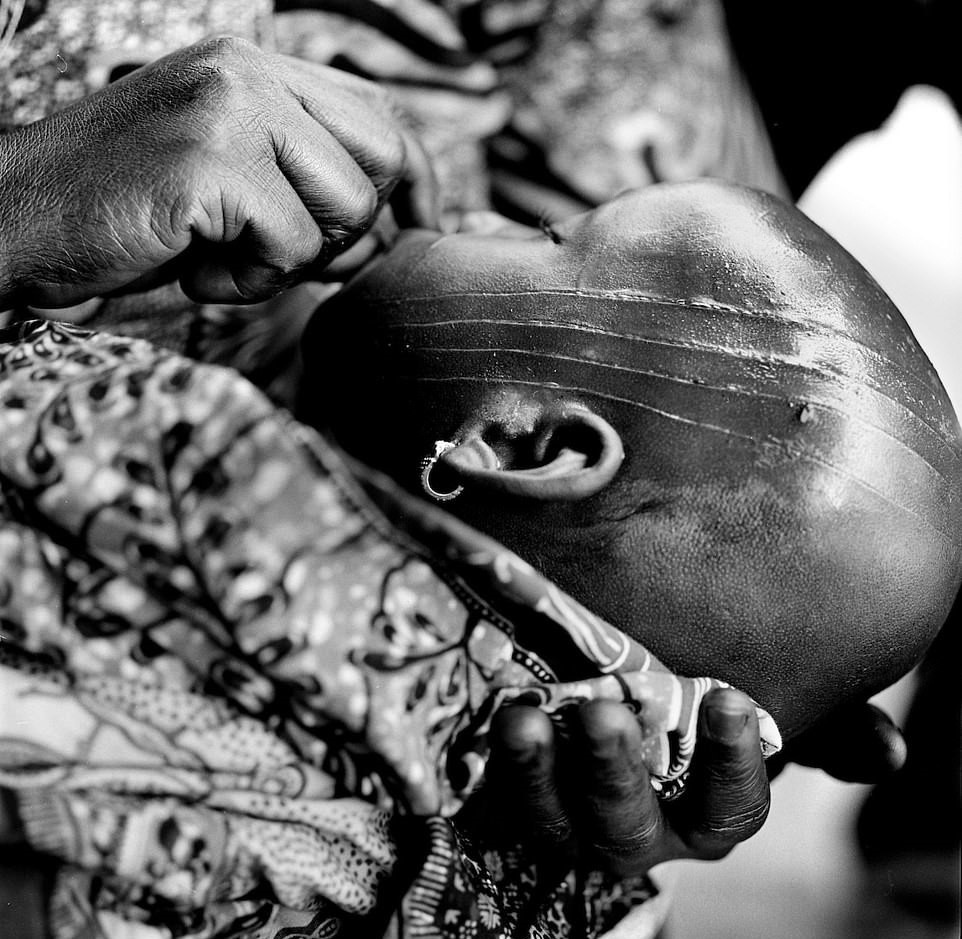 Hu tuc rach mat tre em anh 2