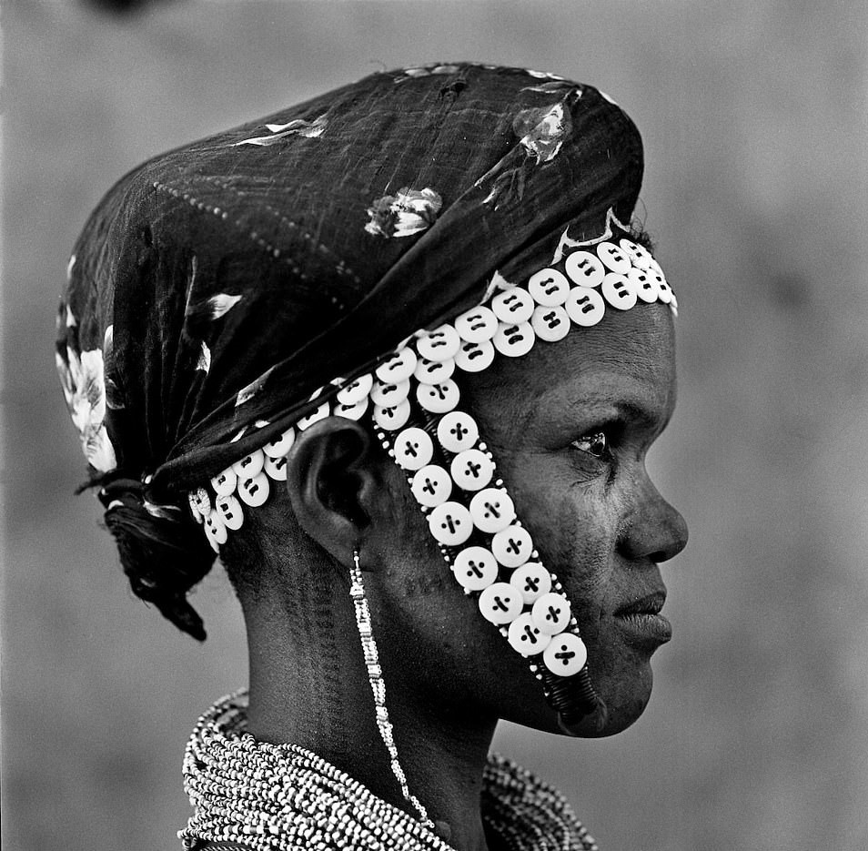 Hu tuc rach mat tre em anh 14