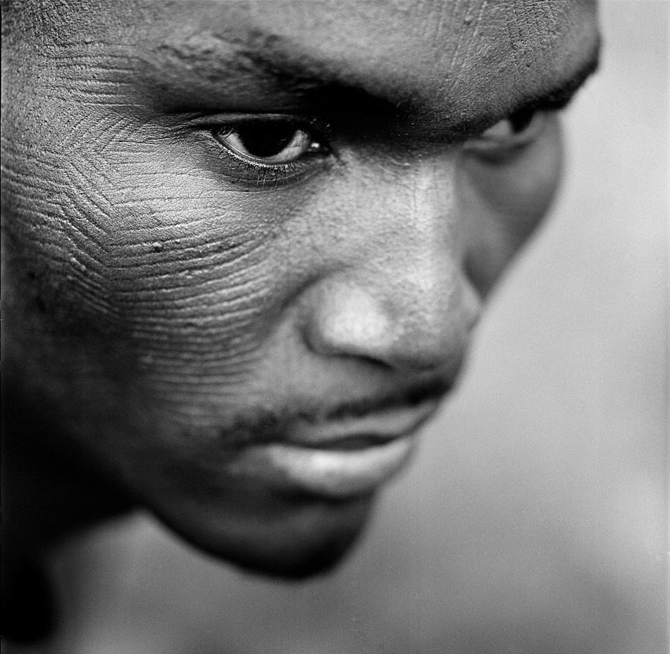 Hu tuc rach mat tre em anh 13