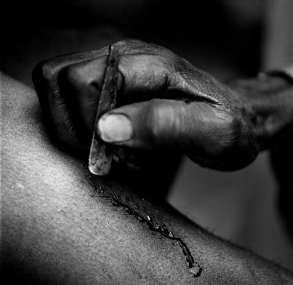 Hu tuc rach mat tre em anh 5