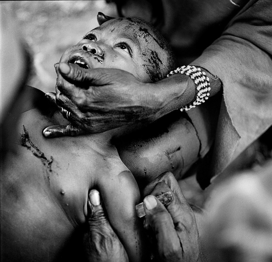 Hu tuc rach mat tre em anh 4