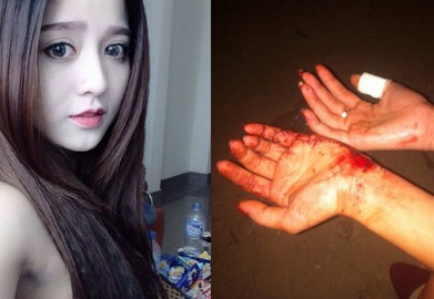 Hot girl clip coi do Gia Lai bi kinh roi trung nguoi hinh anh