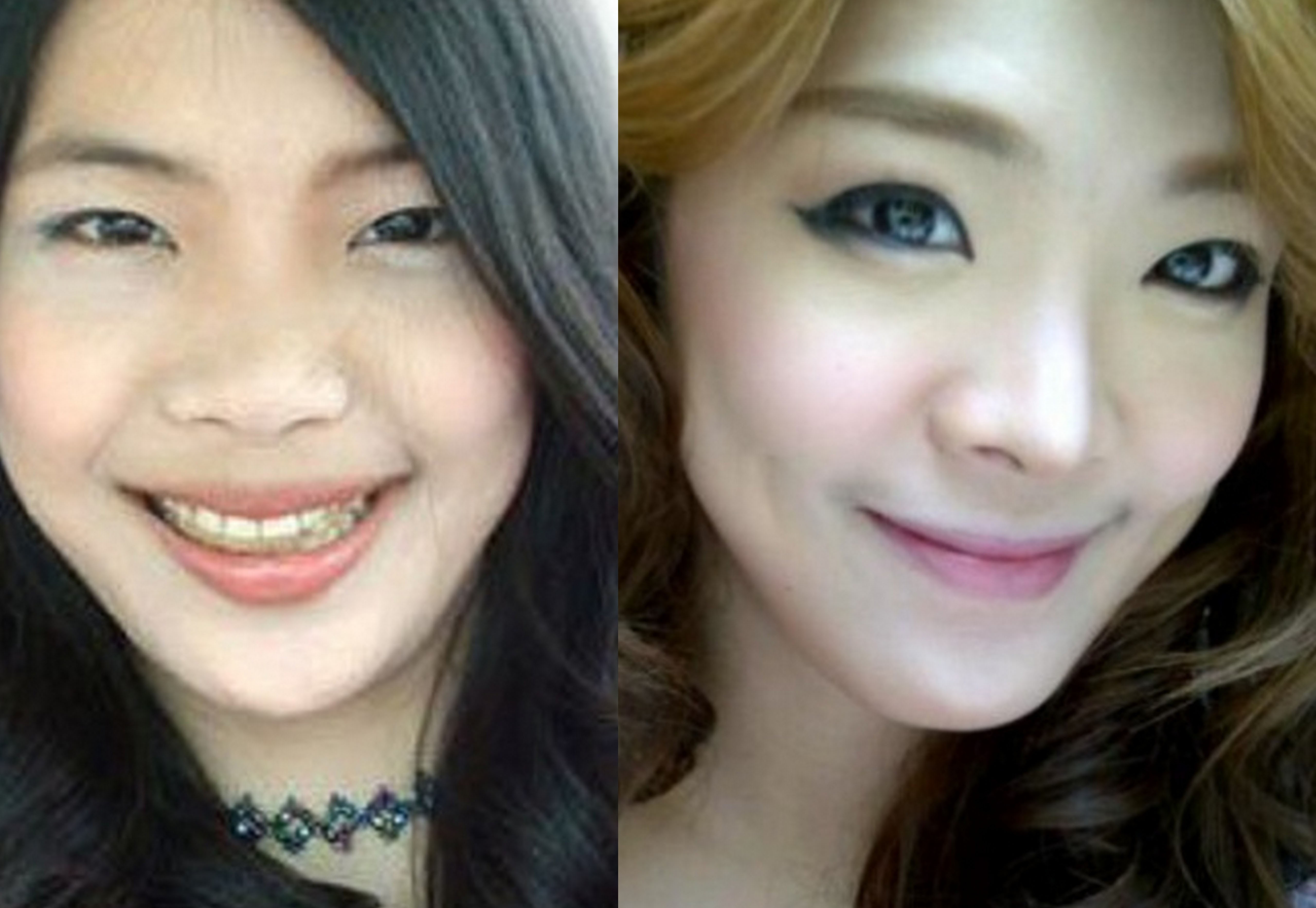 Co gai xau xi phau thuat thanh kieu nu noi tieng Thai Lan hinh anh