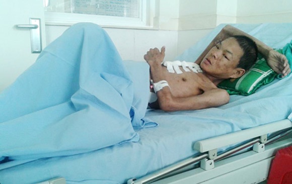 Chang trai quyet tu hon khi mac benh hiem ngheo hinh anh
