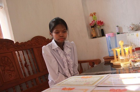 Nghi luc cua nu sinh mac benh da san sui nhu vo cay hinh anh