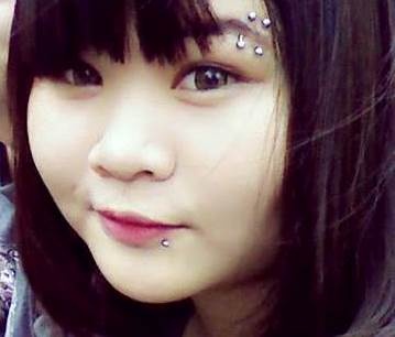 Nu sinh lop 12 co 26 lo khuyen tren nguoi hinh anh