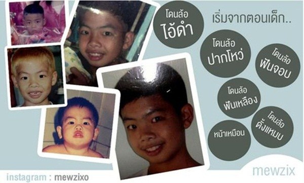 Từ khi còn nhỏ, Milliken đã sở hữu chiếc mũi hơi hếch, đôi mắt 1 mí và đôi môi khá dày.