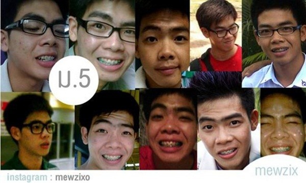 Do hàm răng không được bằng và đều, Milliken đã dùng niềng để chỉnh răng cho đẹp.