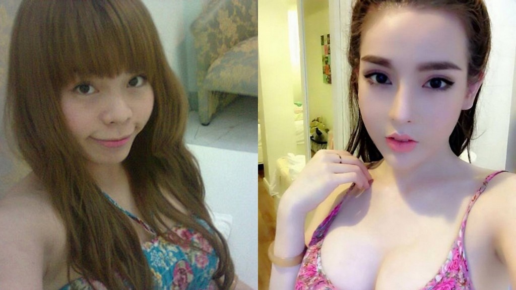 Co gai Viet tu vit hoa thien nga sau phau thuat tham my hinh anh