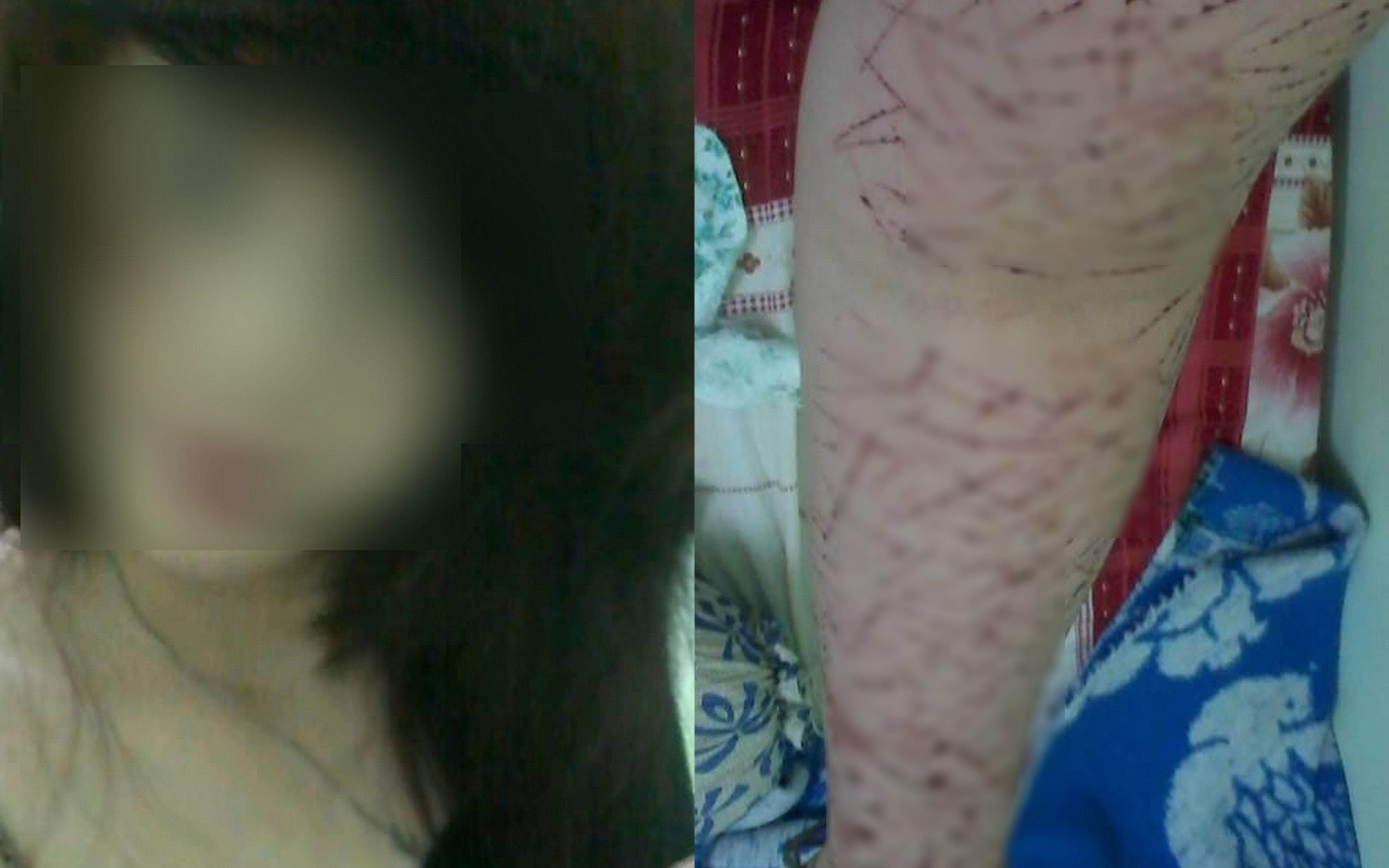 Thieu nu rach tay chi chit khien dan mang giat minh hinh anh