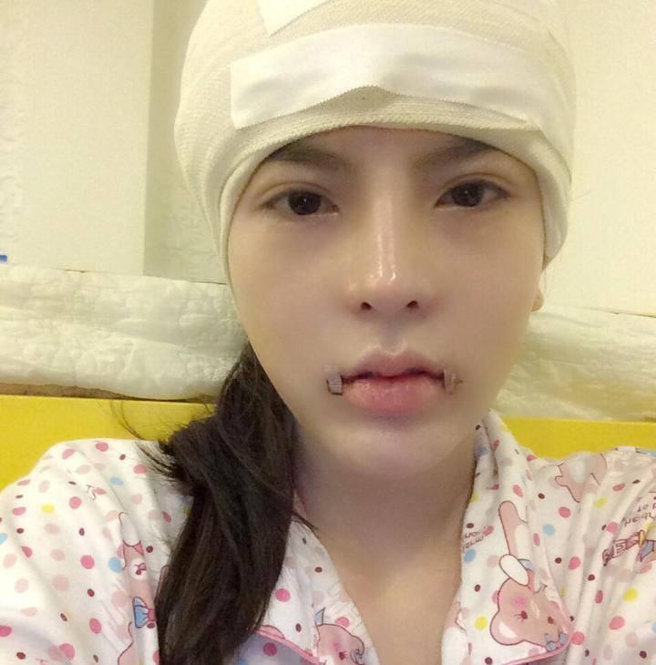 Van Tokyo lai phau thuat moi cuoi canh cung, don thai duong hinh anh