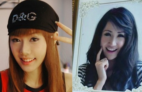 Nhung cai chet vi phau thuat tham my chan dong gioi tre hinh anh