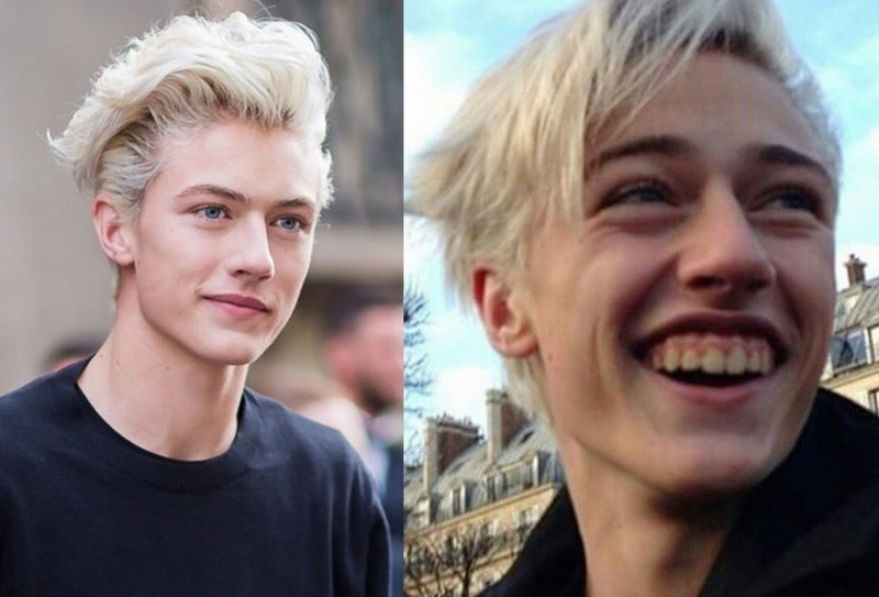 Mat that gay that vong cua hot boy 16 tuoi noi tieng mang hinh anh