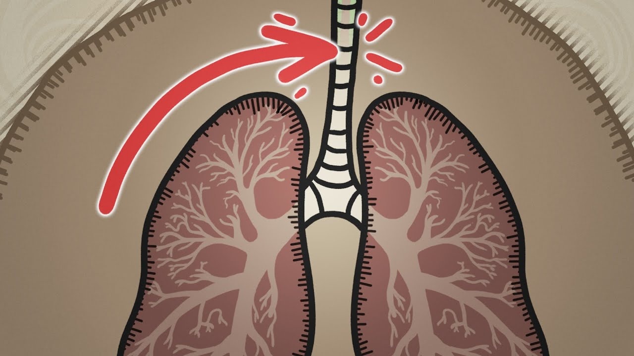 Phoi cua loai nguoi co mot khuyet tat nghiem trong hinh anh