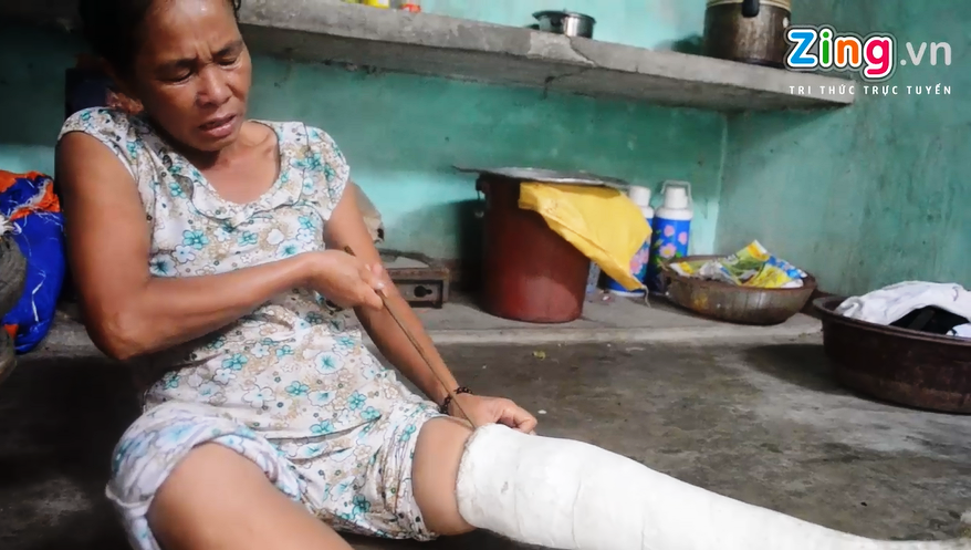 Tam su cua nguoi phu nu 4 nam mang chan bang bot hinh anh