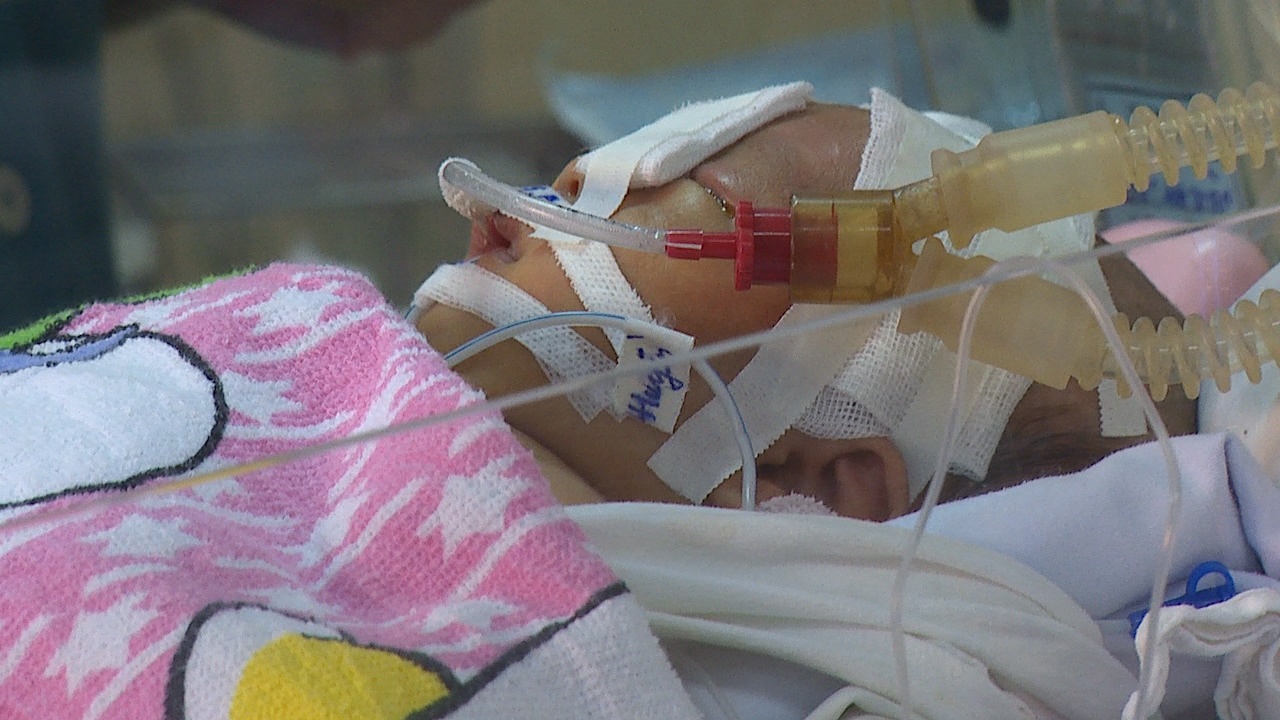 Bac si cong bo suc khoe be trai bi dao dam xuyen dau hinh anh