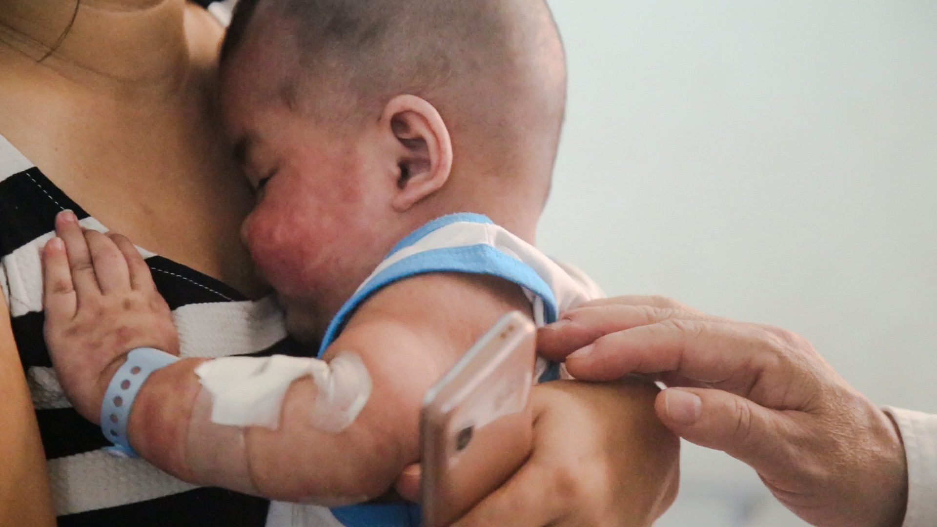 Bo truong Y te canh bao nguy co lay benh soi tai ngay benh vien hinh anh