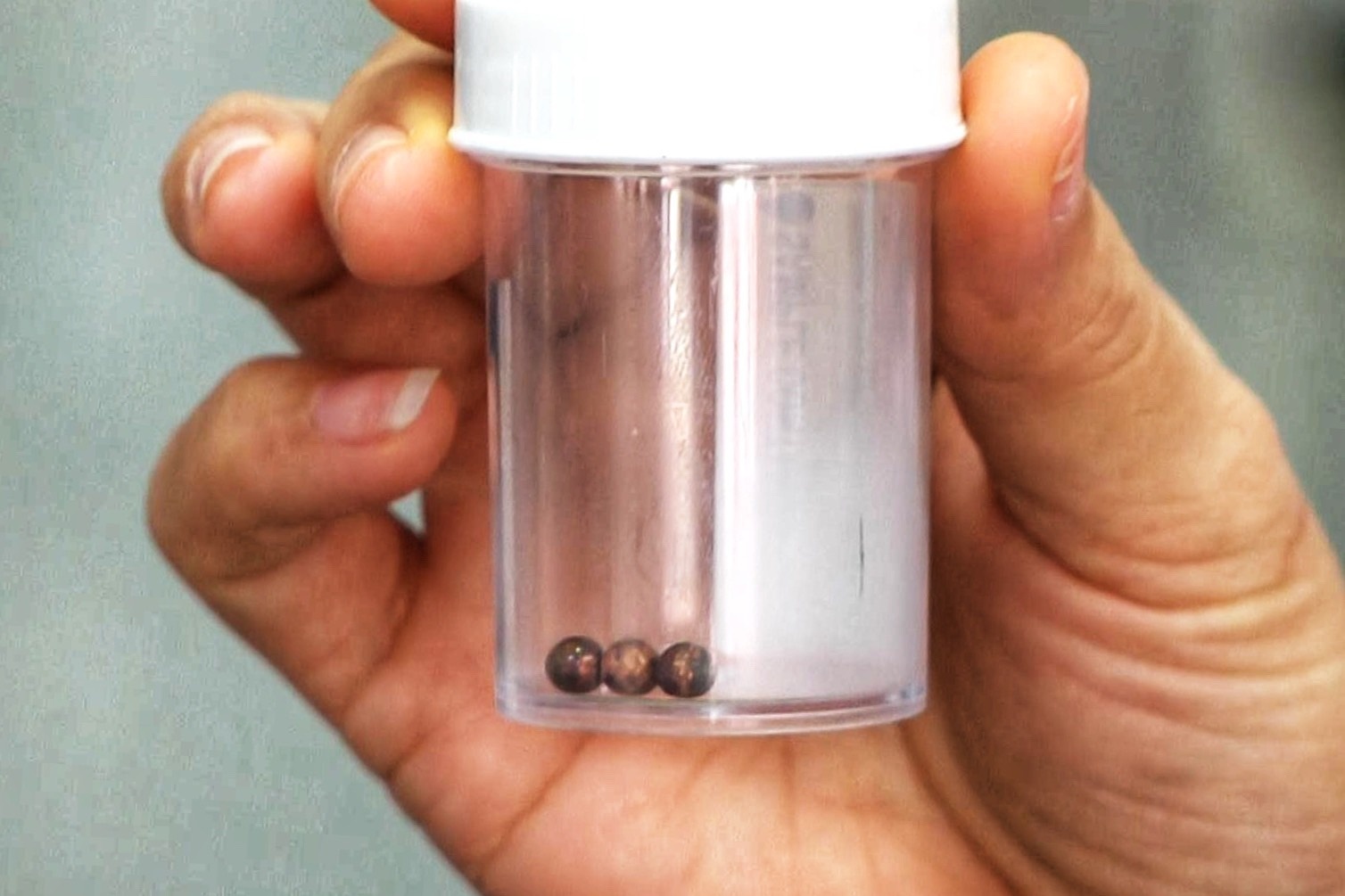 Cuu be trai nuot 3 vien bi nam cham vao bung hinh anh