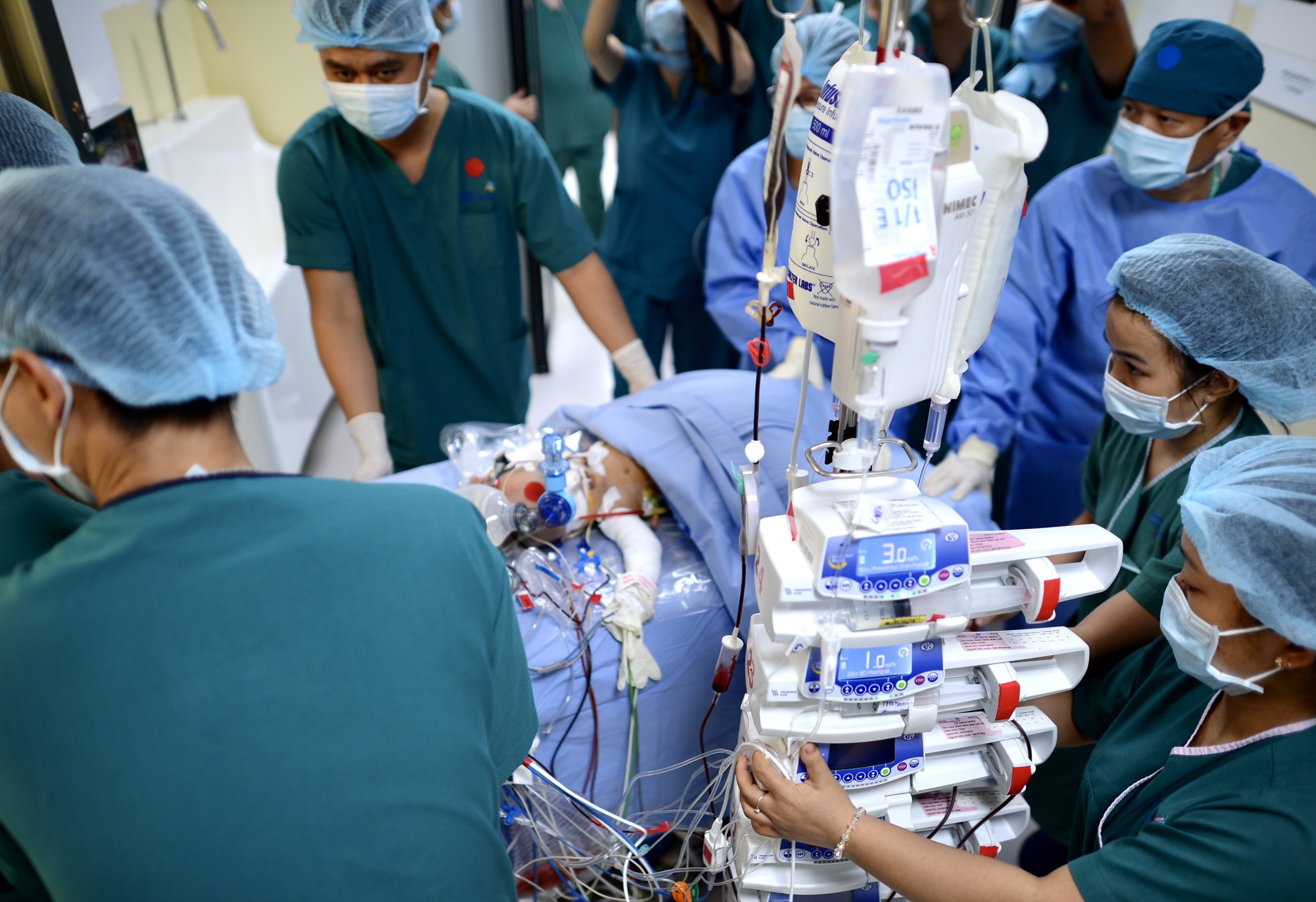 Khoanh khac tach roi hai be song sinh dinh lien hinh anh