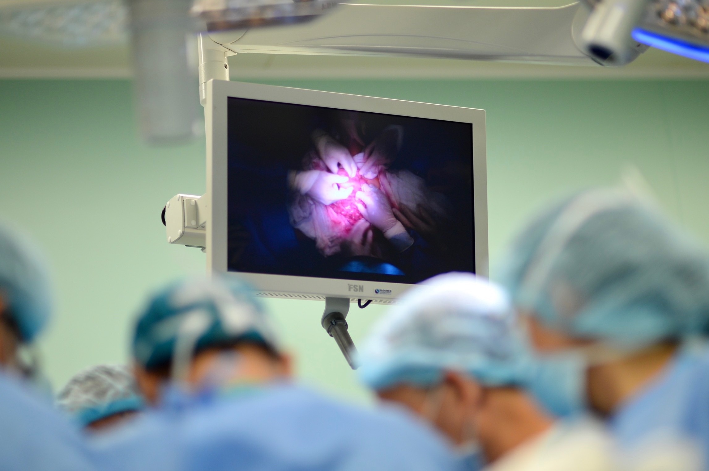 Tach thanh cong co quan tieu hoa cho cap song sinh dinh lien hinh anh