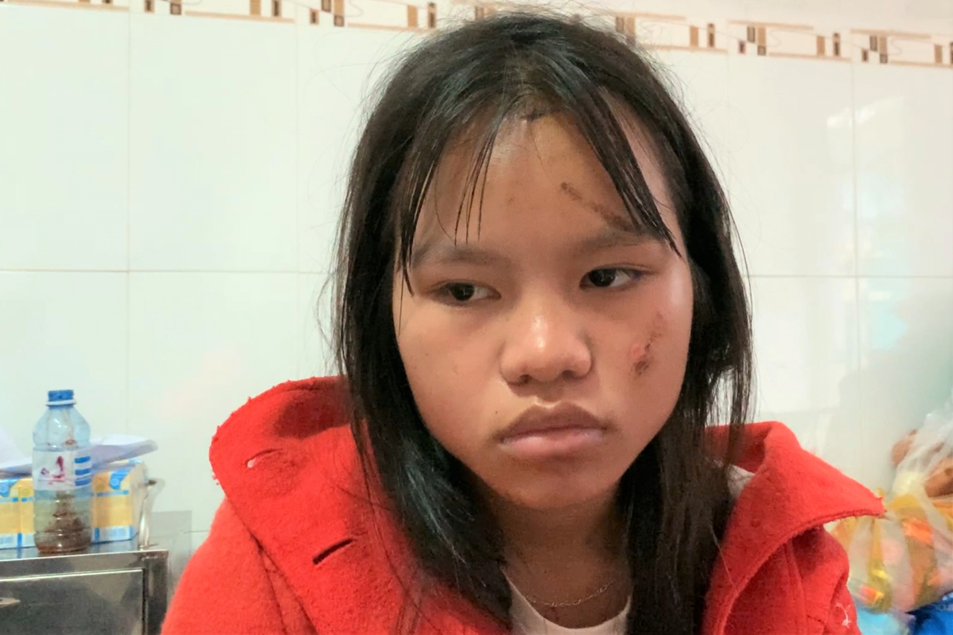 'Ba em mat, di va chau cung mat' hinh anh