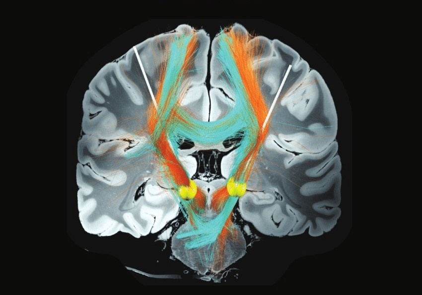 Goc khuat ve xuat ban hoc thuat: Hon 40 bien tap vien tu chuc hinh anh