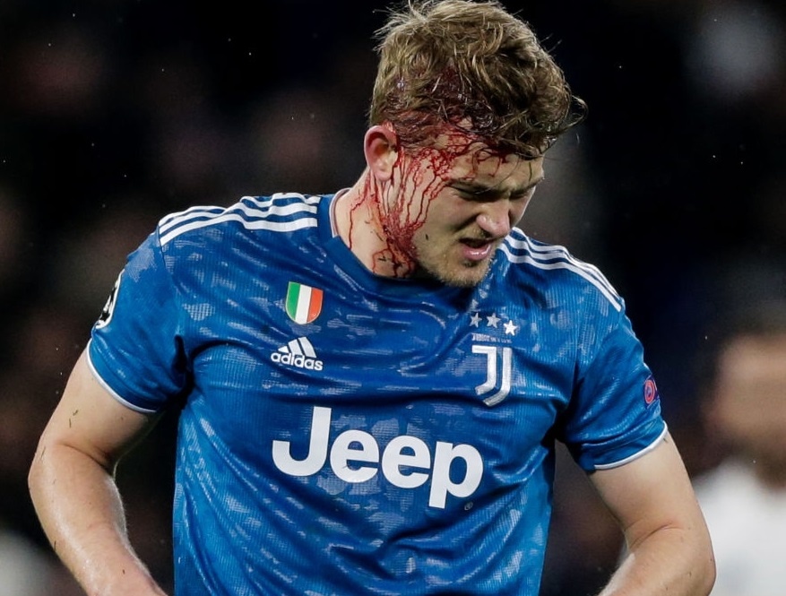 De Ligt do mau trong that bai cua Juventus hinh anh