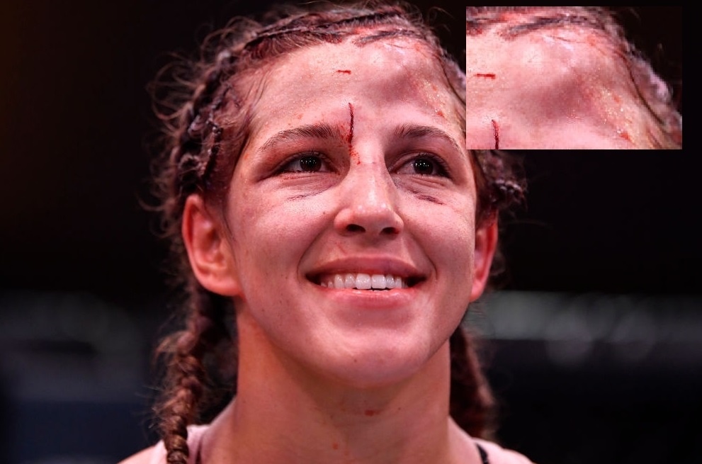 Khuon mat nu vo si bien dang sau 5 hiep chiu don hinh anh