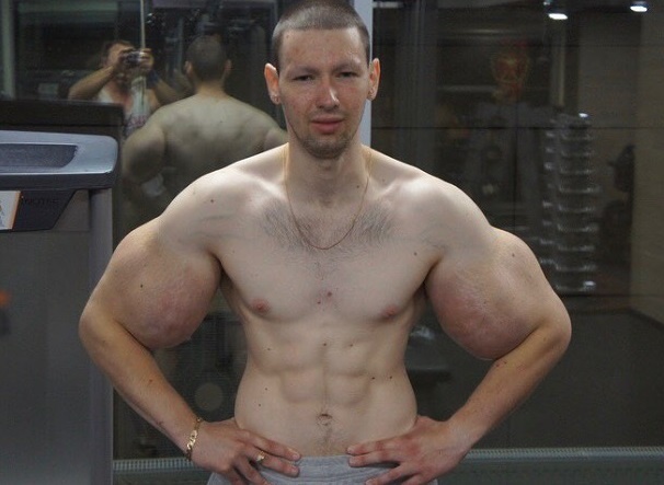 Vo si co bap tay to 61 cm bi knock-out sau mot hiep hinh anh