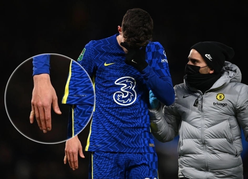 Havertz van thi dau du bi gay ngon tay hinh anh