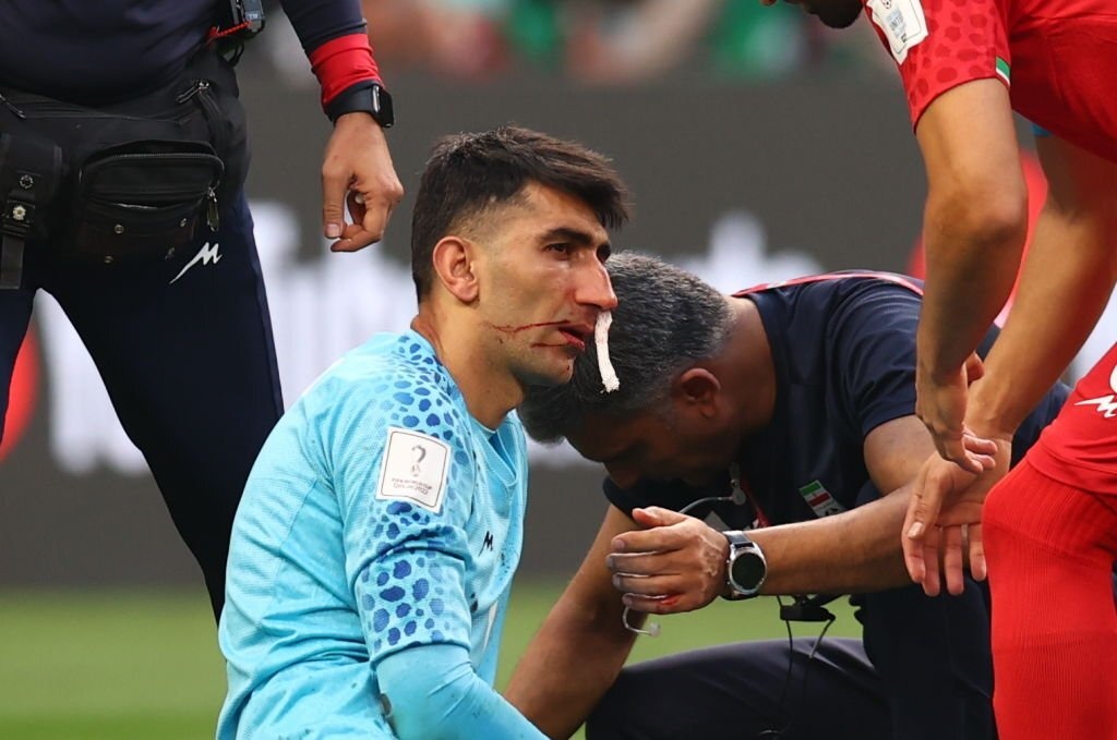 Rui ro khi cho thu mon Iran vao san sau va cham manh o dau hinh anh