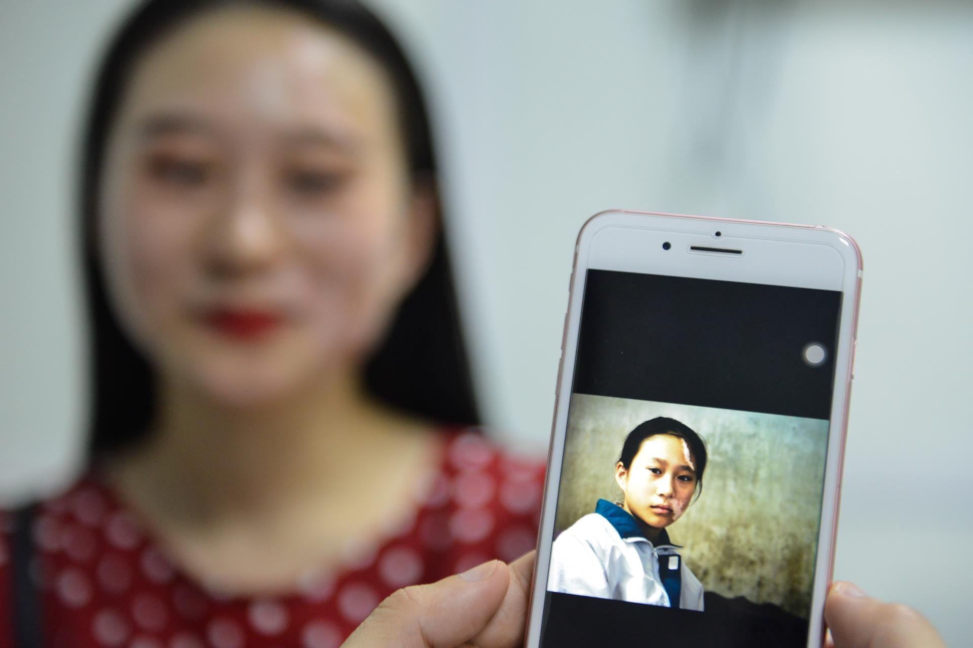 Vuot qua can benh bach bien anh 2