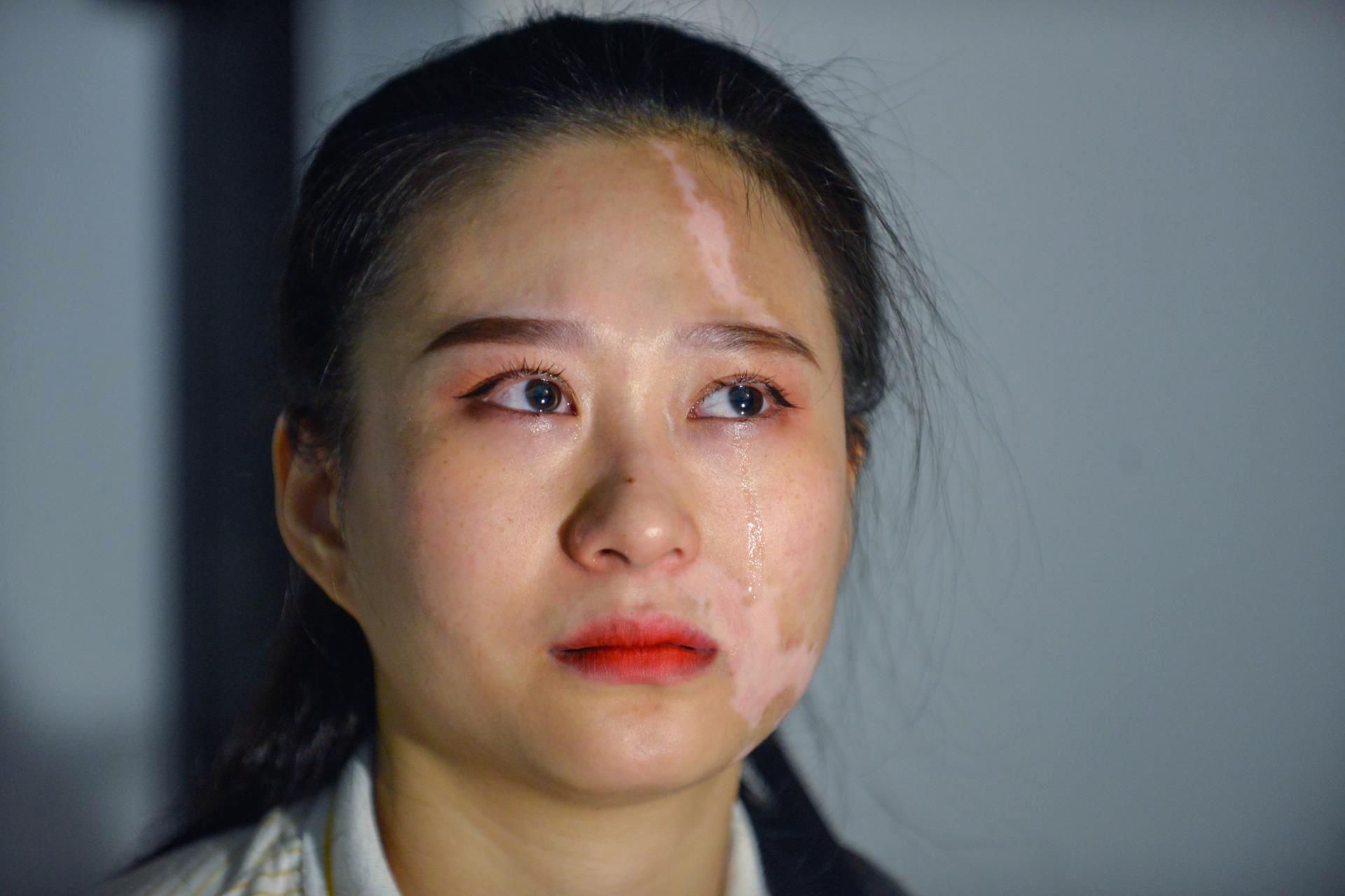 Vuot qua can benh bach bien anh 4