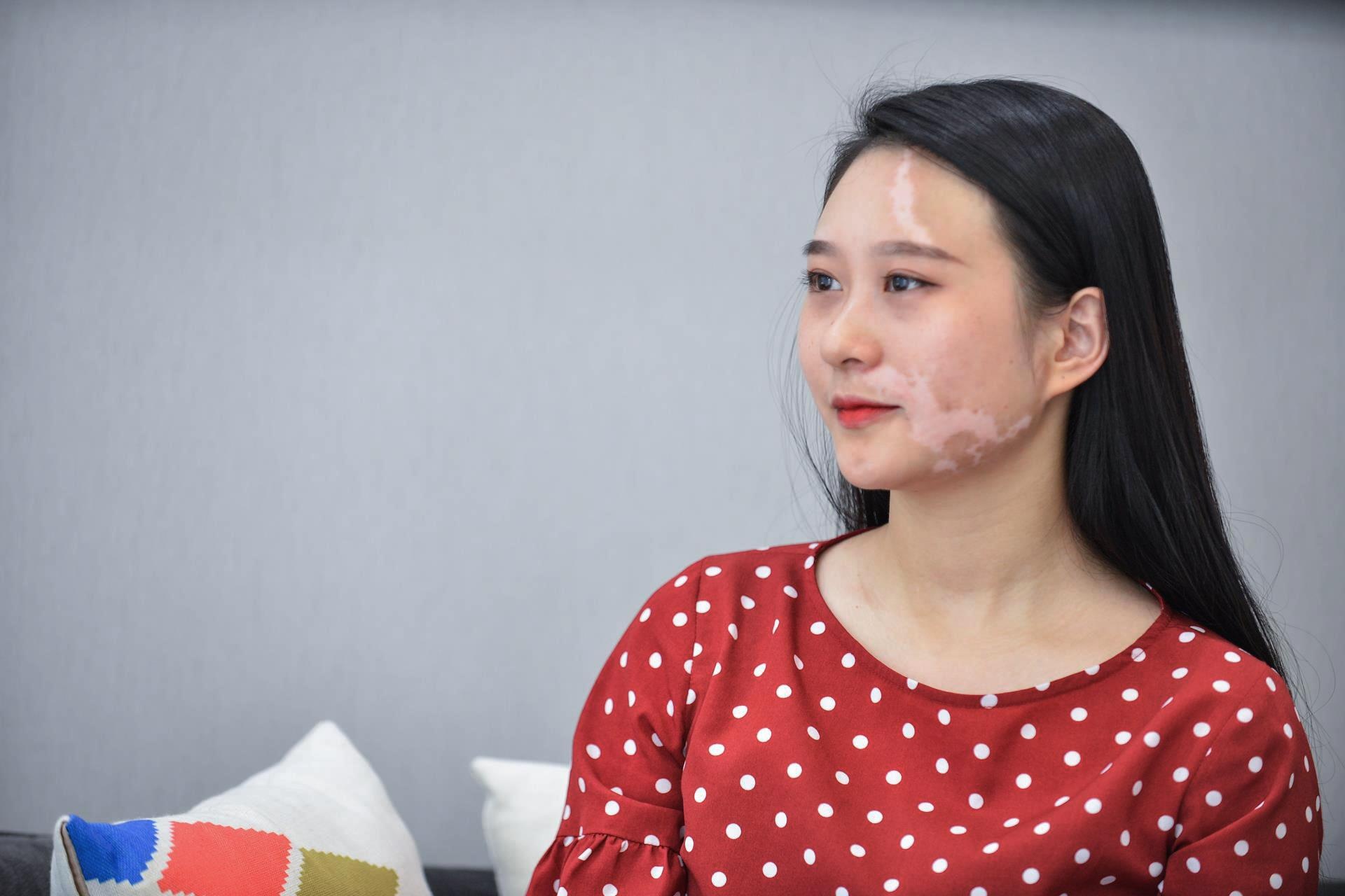 Vuot qua can benh bach bien anh 17