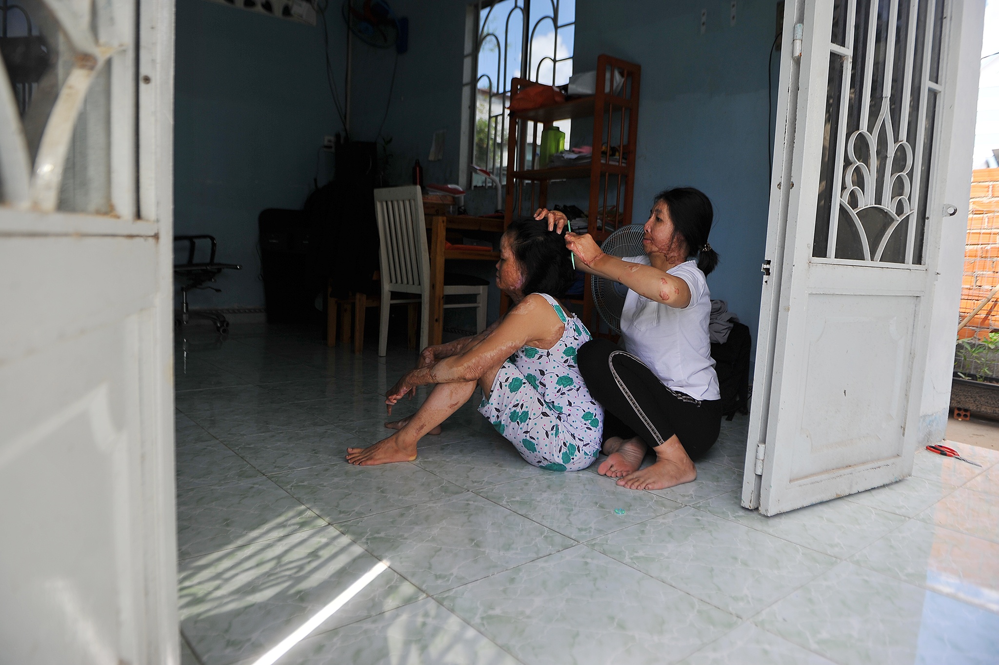 vo bi chong tuoi xang dot anh 22