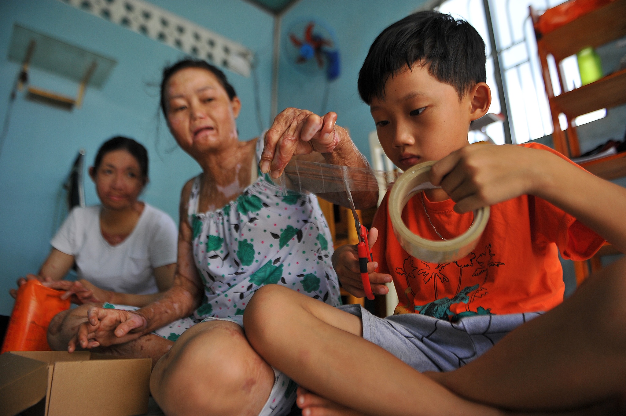 vo bi chong tuoi xang dot anh 31