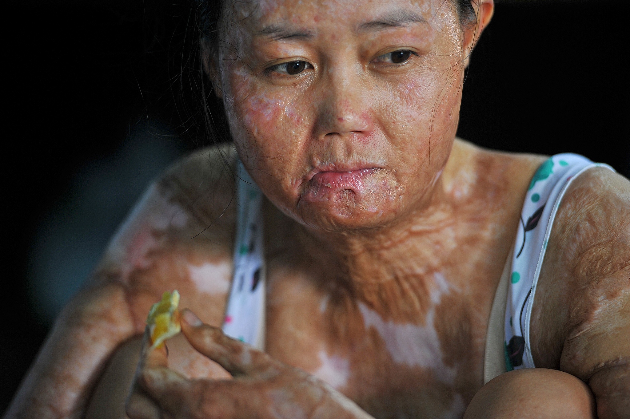 vo bi chong tuoi xang dot anh 2