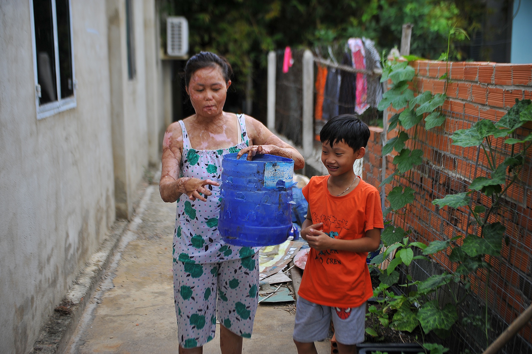 vo bi chong tuoi xang dot anh 38