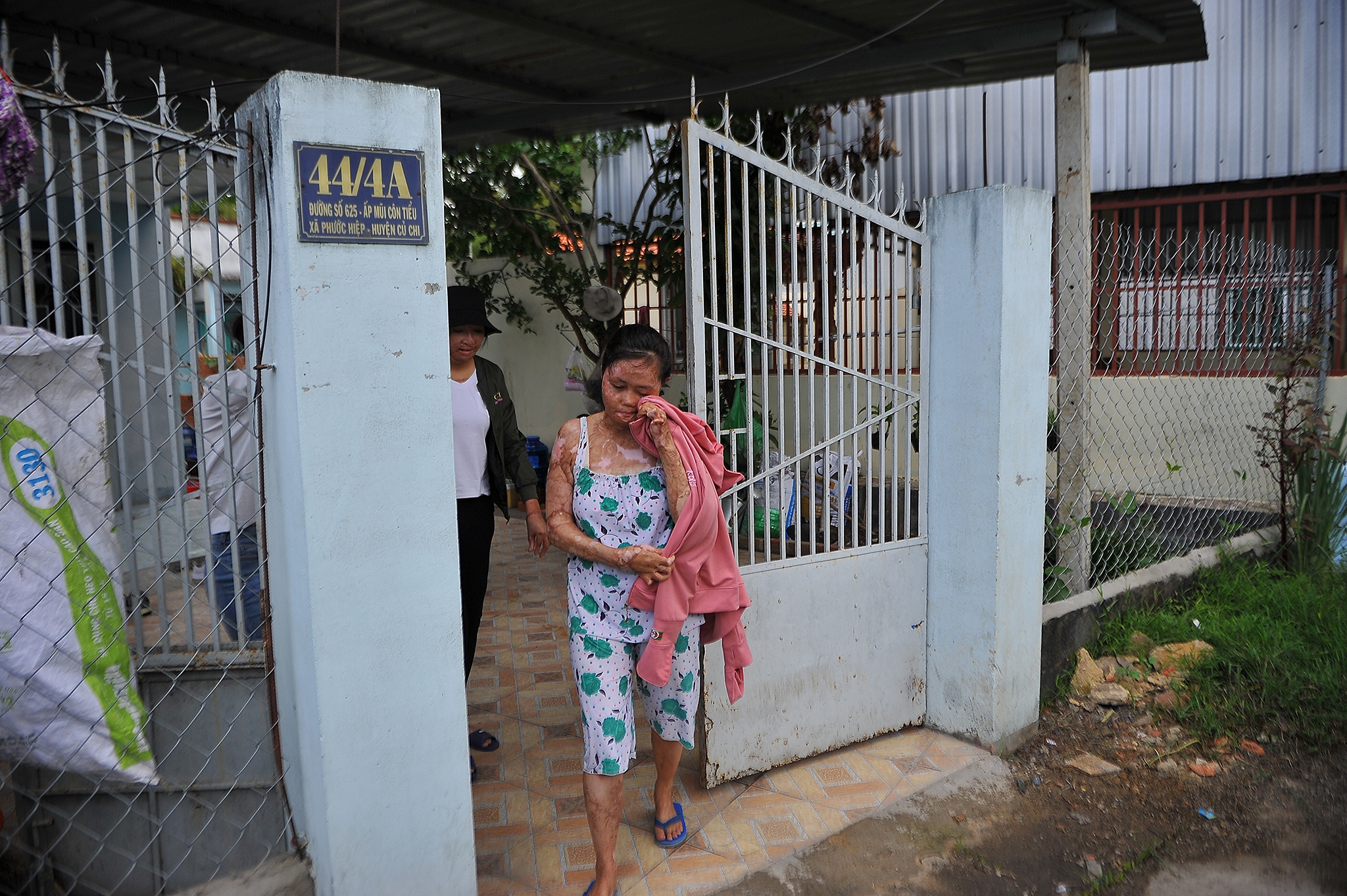 vo bi chong tuoi xang dot anh 18