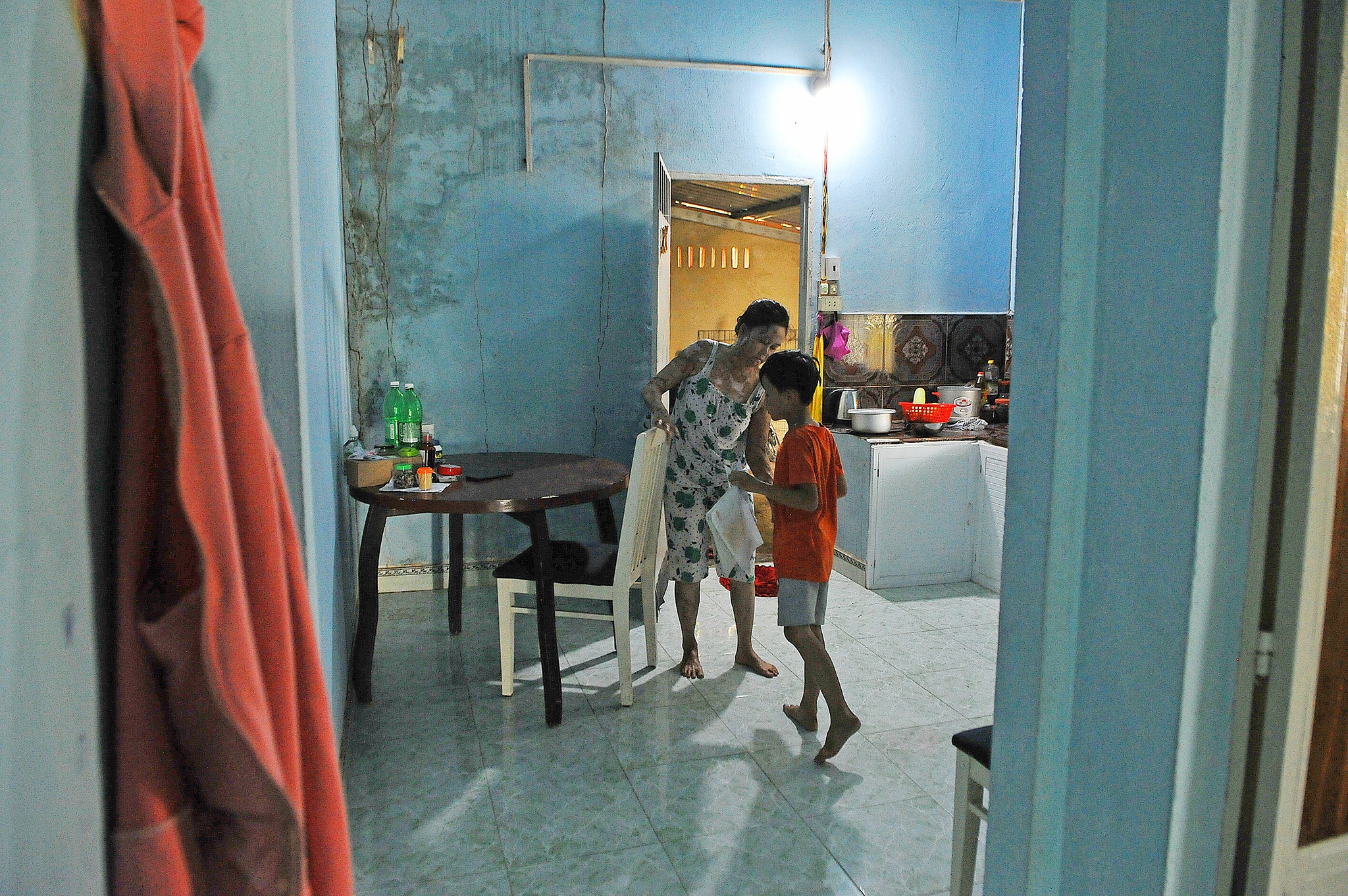 vo bi chong tuoi xang dot anh 30