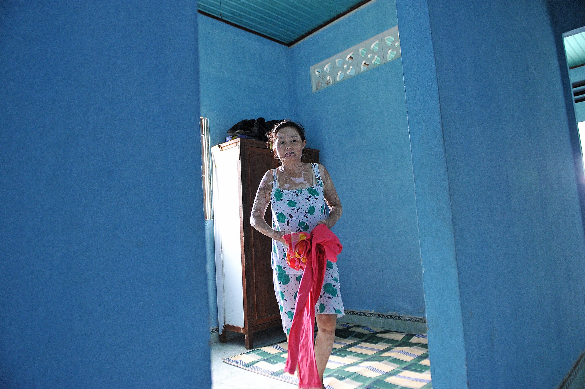 vo bi chong tuoi xang dot anh 9