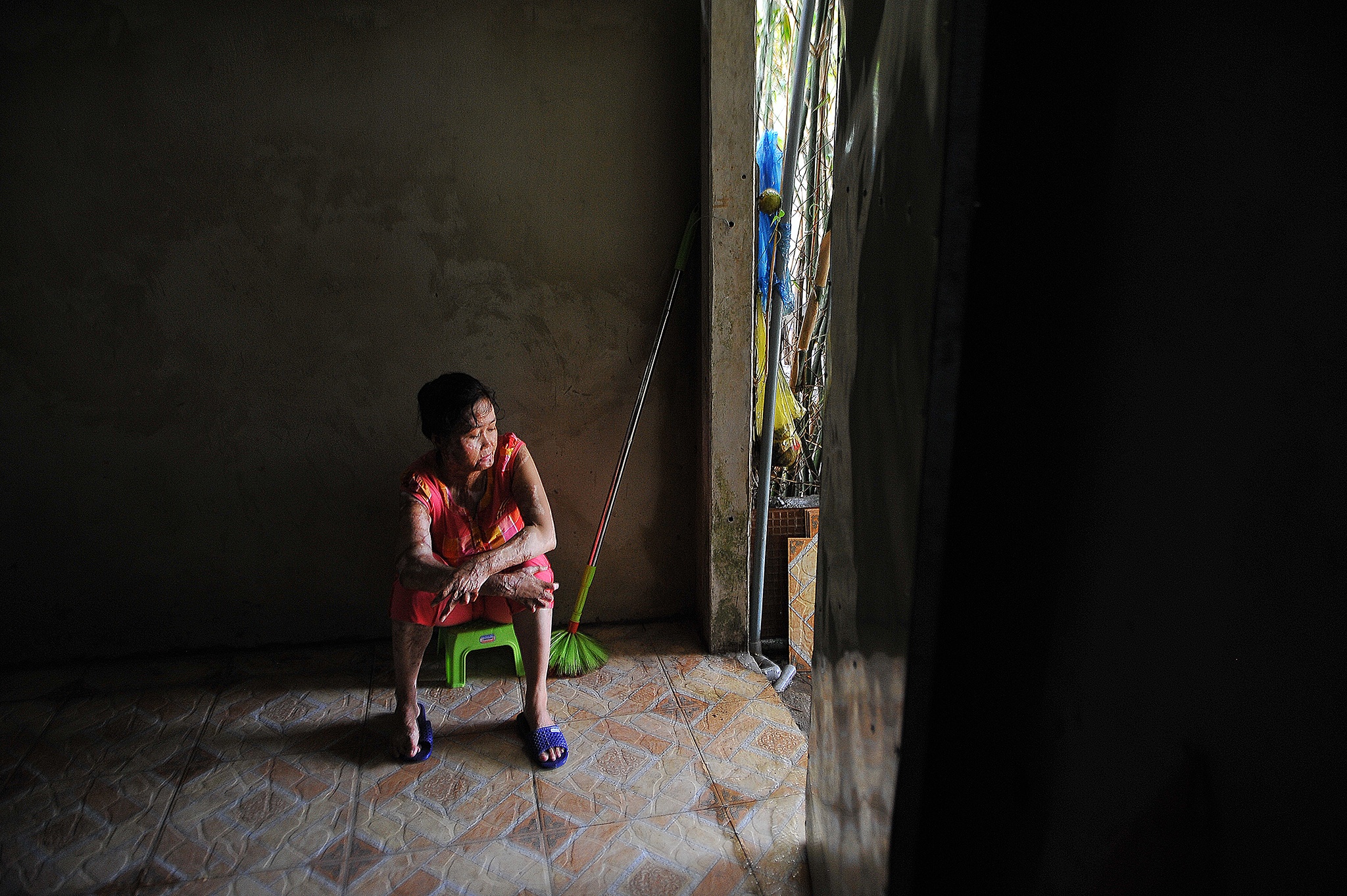 vo bi chong tuoi xang dot anh 11